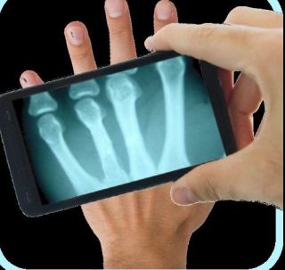 X_ray scanner