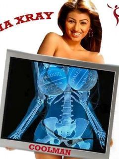 XRay Scanner